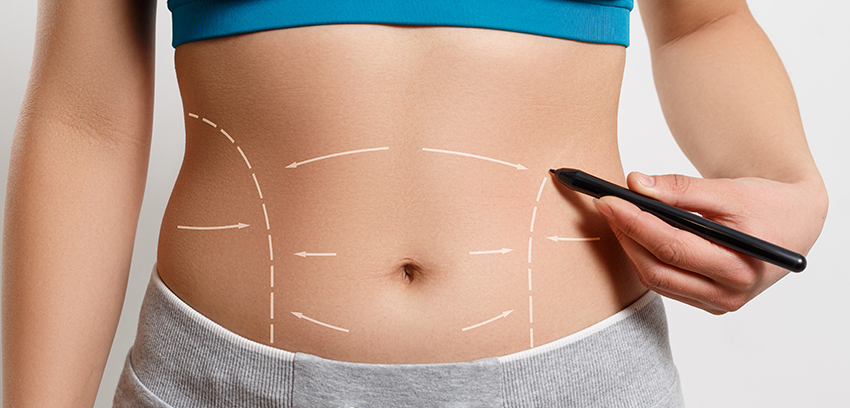 Tummy tuck plastic surgery procedure in İstanbul