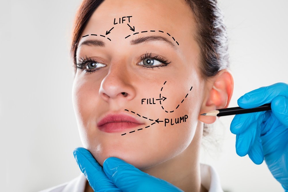 Facelift Surgery in Istanbul, Turkey